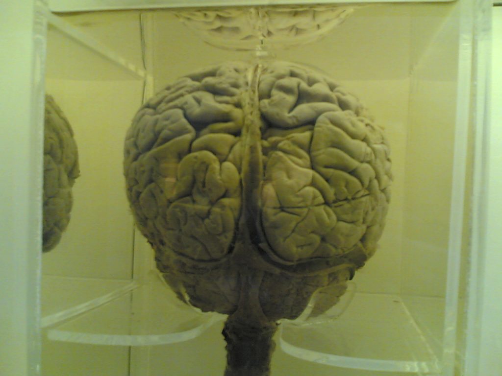 Natural History Museum - cervello umano